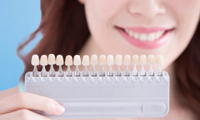 In-Depth Evaluation for Porcelain Veneers Candidacy