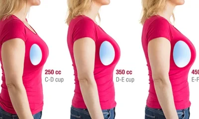 Choosing the Right Breast Prosthesis: Tips, Options, and Lifestyle Advice