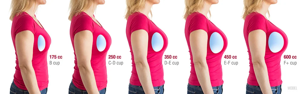 Choosing the Right Breast Prosthesis: Tips, Options, and Lifestyle Advice 26 Choosing the Right Breast Prosthesis: Tips, Options, and Lifestyle Advice
