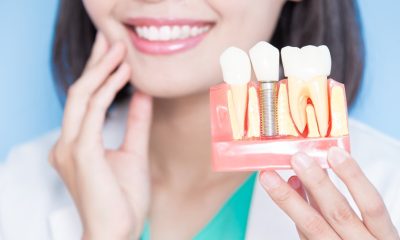 How Full Mouth Dental Implants Enhance Quality of Life