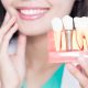 How Full Mouth Dental Implants Enhance Quality of Life