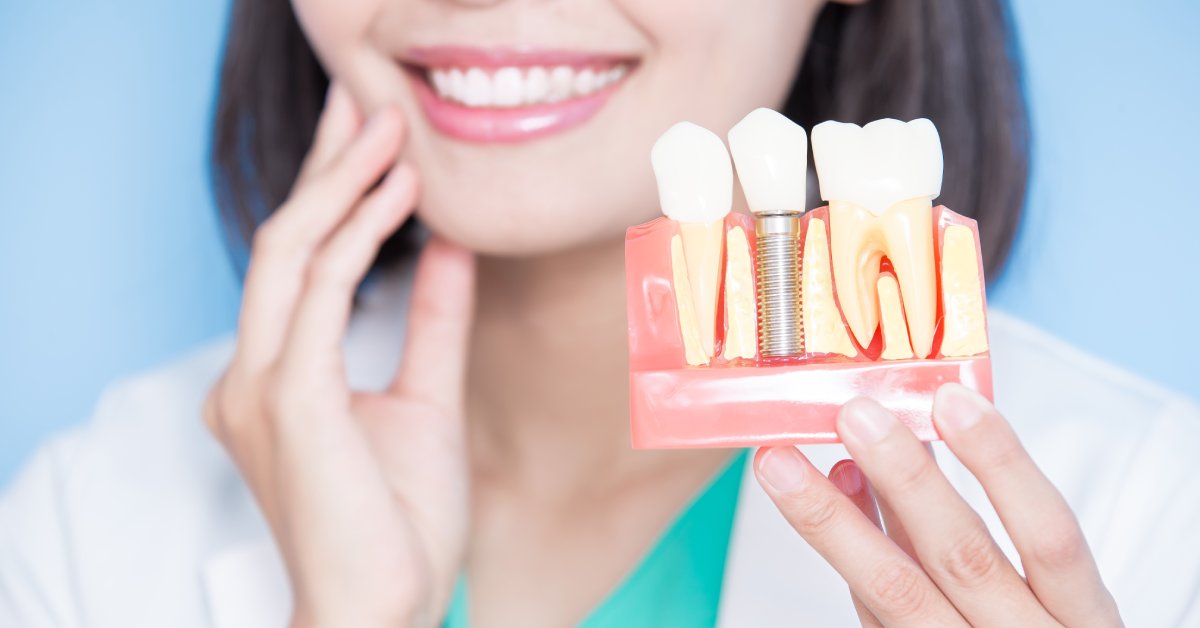 How Full Mouth Dental Implants Enhance Quality of Life