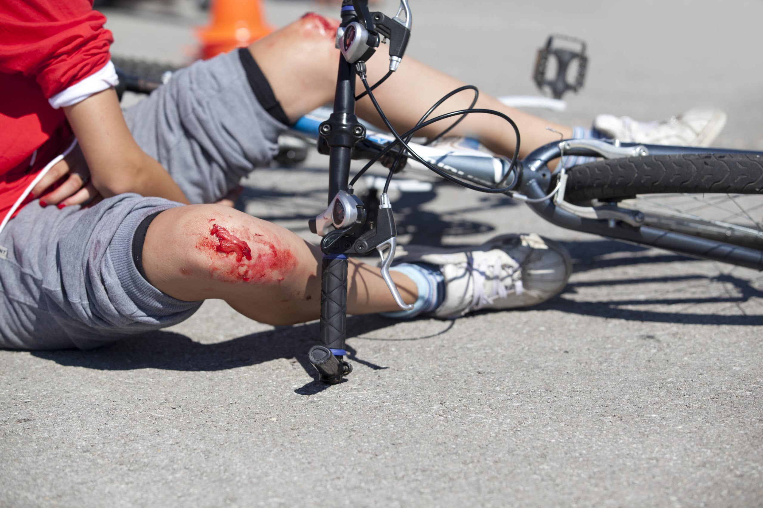 Bicycle Accident Injuries